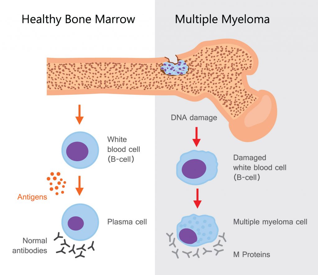 Blood Cancer