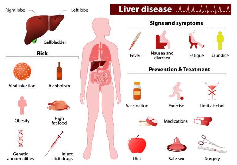 Liver Cancer DiseasesAndConditions